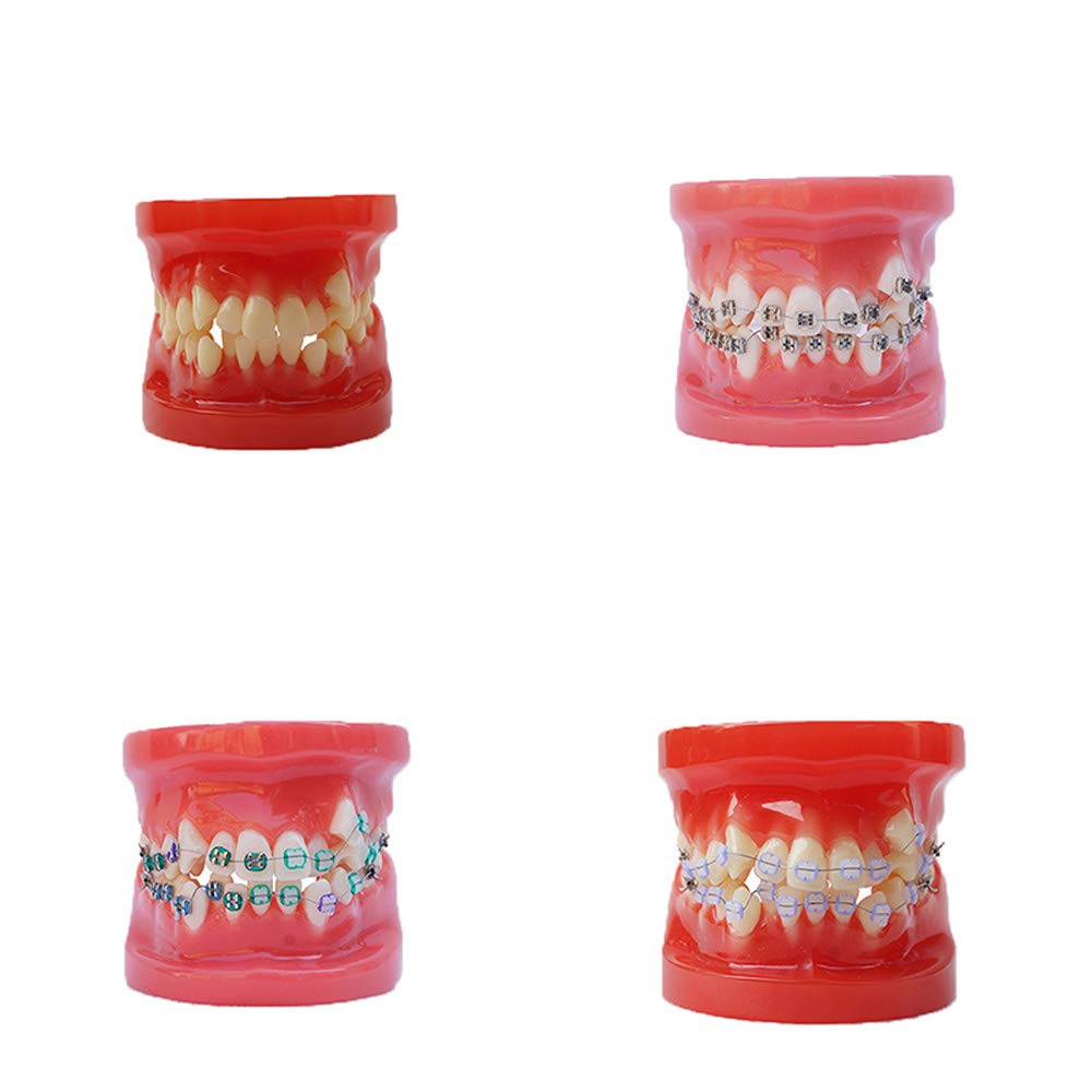 Tooth model dental model dentist pathology teaching model laboratory research learning use (Full cer