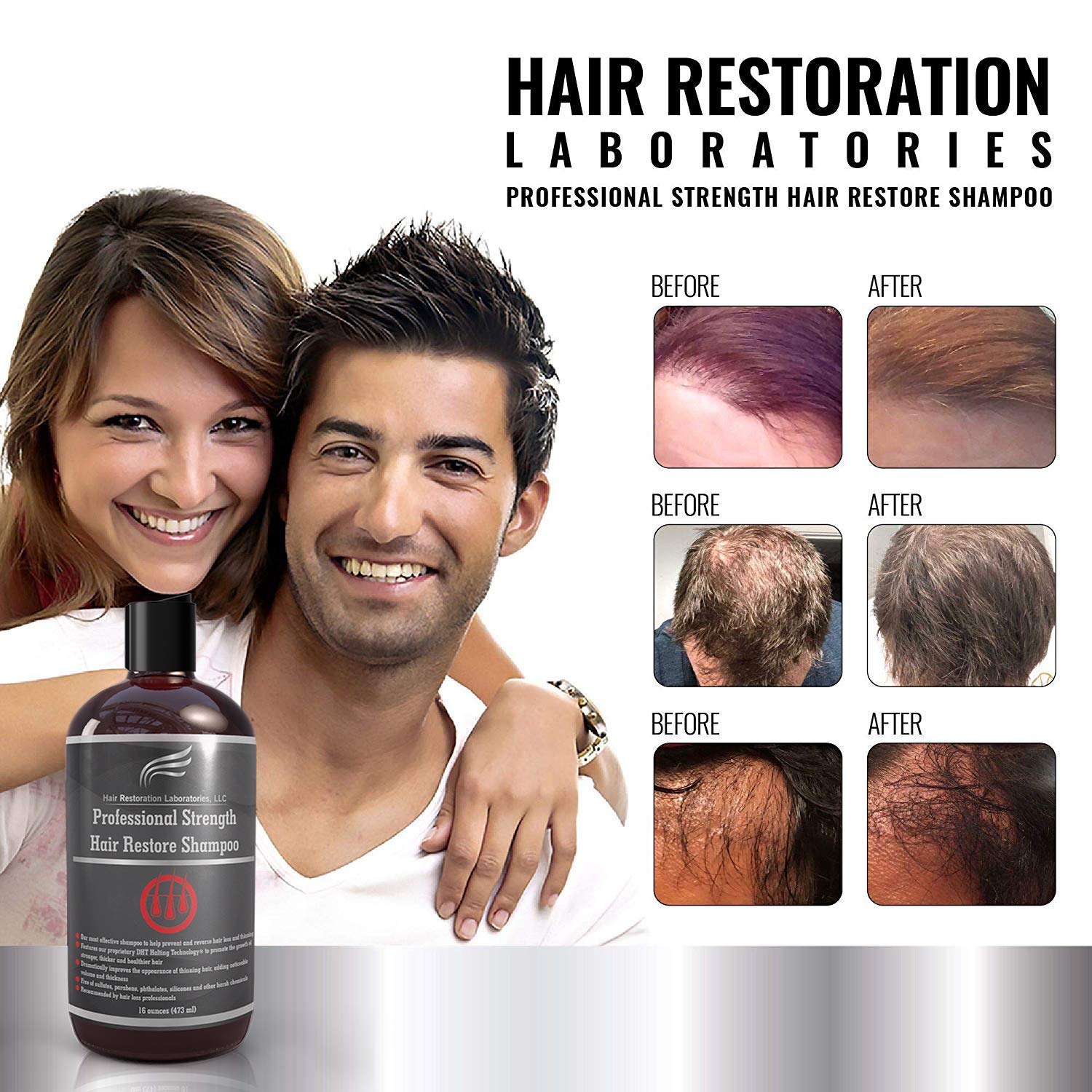Hair Restoration Laboratories" Professional Strength DHTBlocking Hair