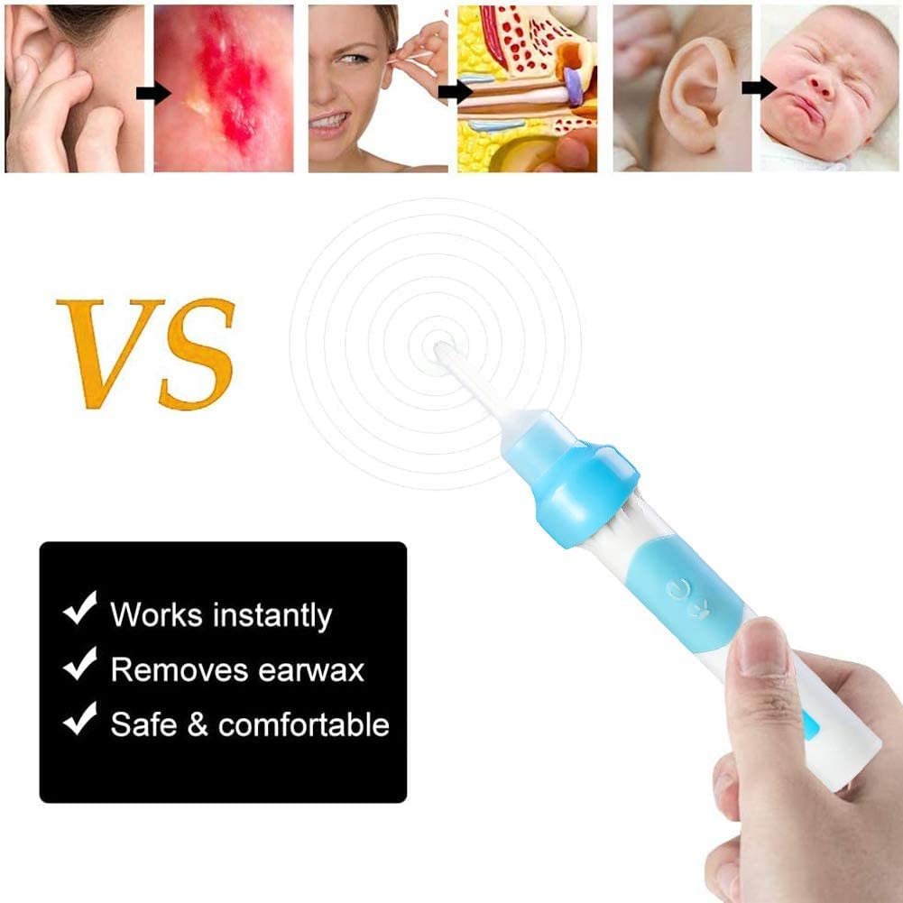 Ear Wax Removal Kit, Safe Ear Cleaner, Electric Earwax Removal Tools, Ear Vacuum Cleaner, 2 Types Ea