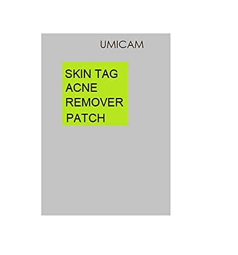 Skin Tag Remover Patches - (108 Pcs) Natural and Frankincense Myrrh Creamy Body 11.5 Ounce and Skin 
