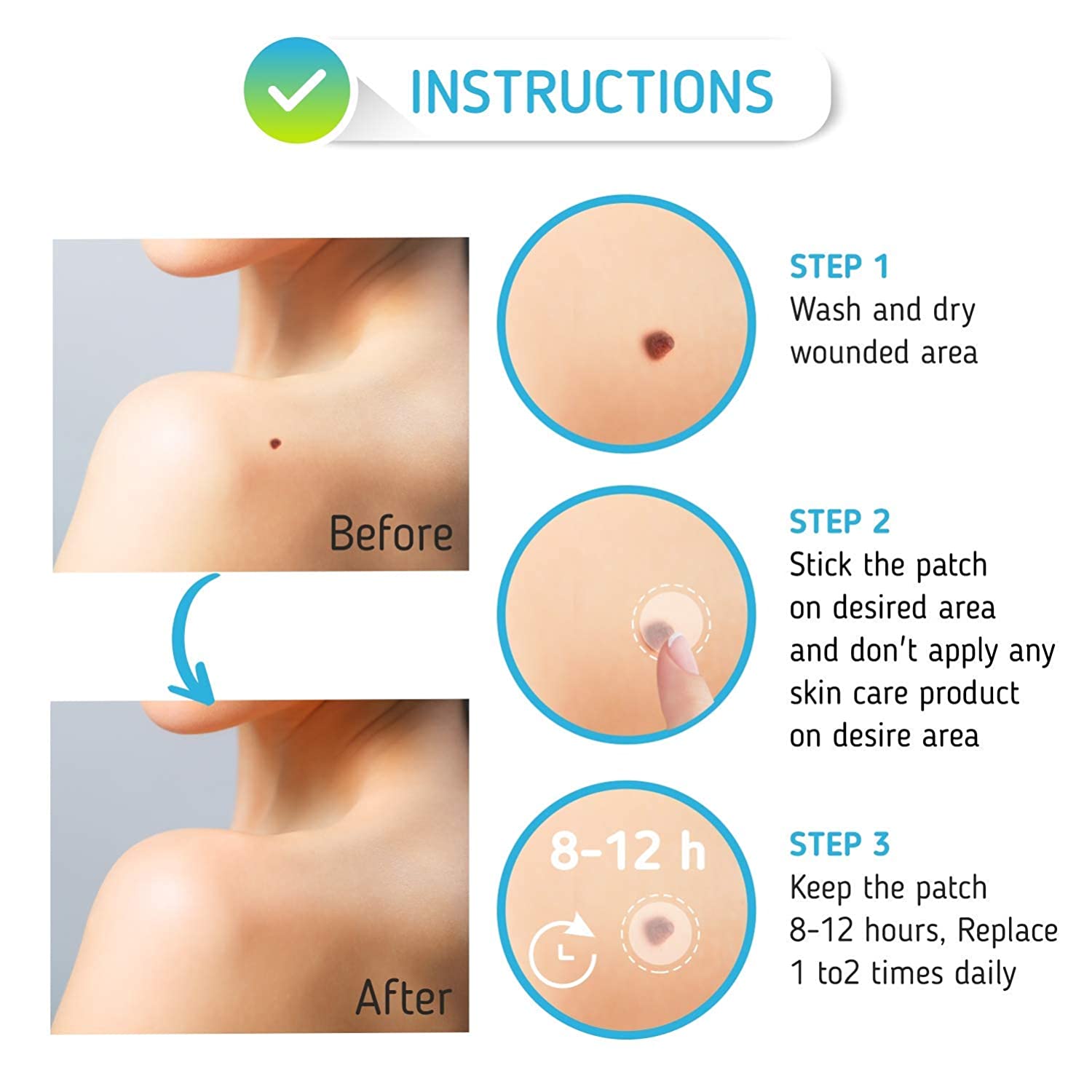 Skin Tag Remover Patches - (108 Pcs) Natural and Frankincense Myrrh Creamy Body 11.5 Ounce and Skin 