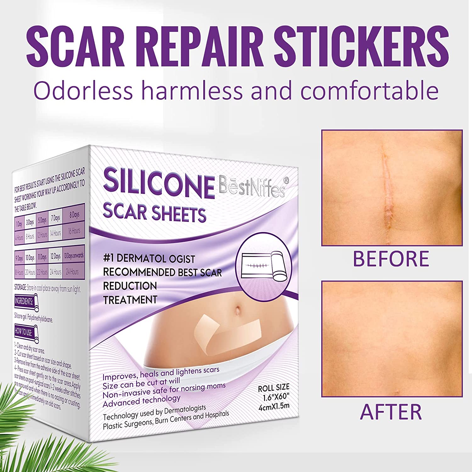 Silicone Scar Sheets, Medical Tape for Scar Painless, Reusable, Easy