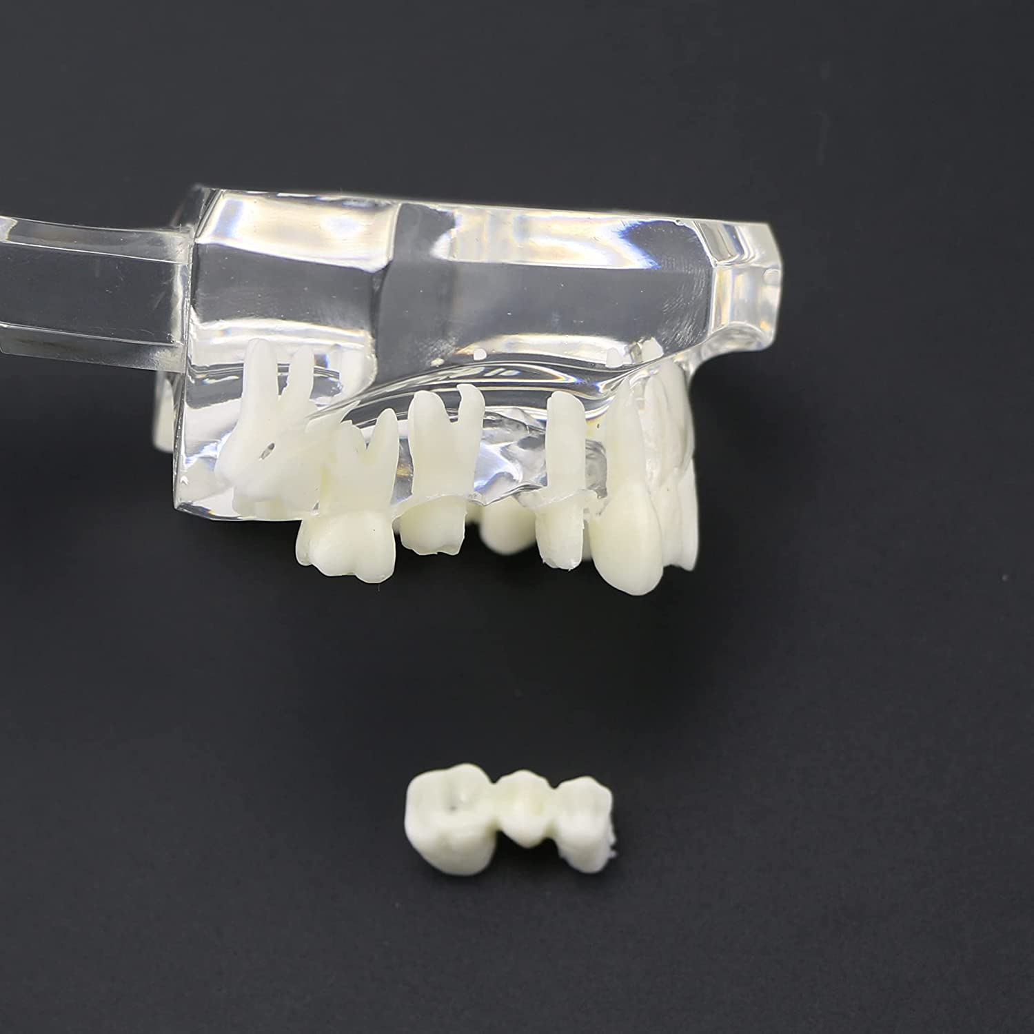 NC Dental Implant Restoration Pathology Bridge Model Teeth Model Teach Study Model 2001C