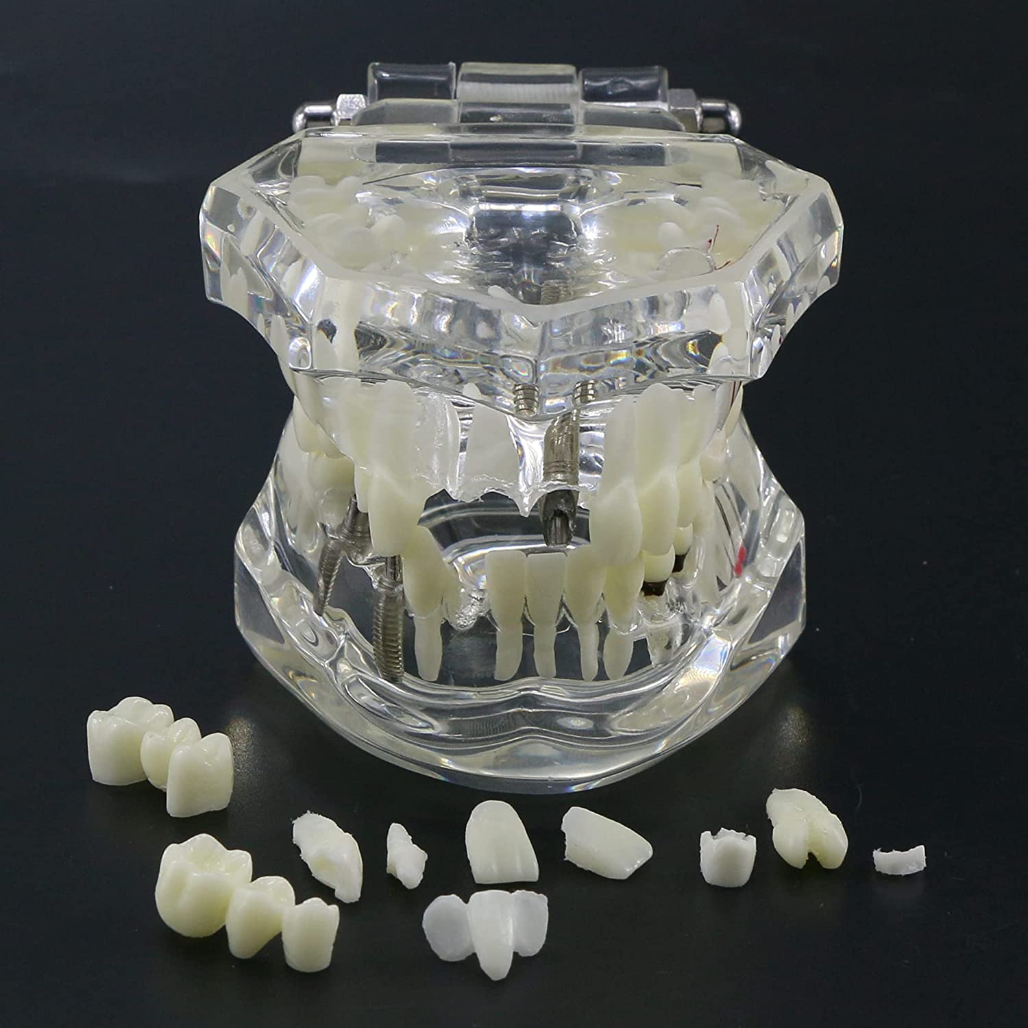 NC Dental Implant Restoration Pathology Bridge Model Teeth Model Teach Study Model 2001C
