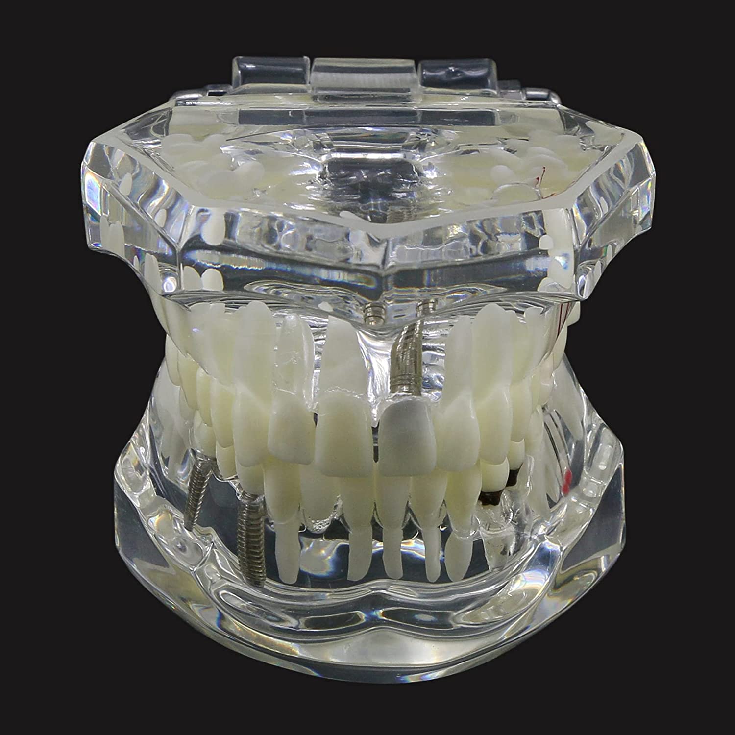 NC Dental Implant Restoration Pathology Bridge Model Teeth Model Teach Study Model 2001C