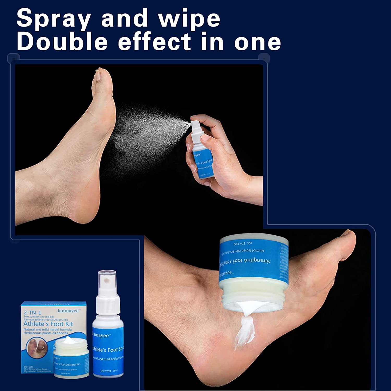 Lanmayee Atheletes Foot Treatment Kit,Athletes Foot Fungi Spray & Antipruritic.Inflamed, Burning,Sme