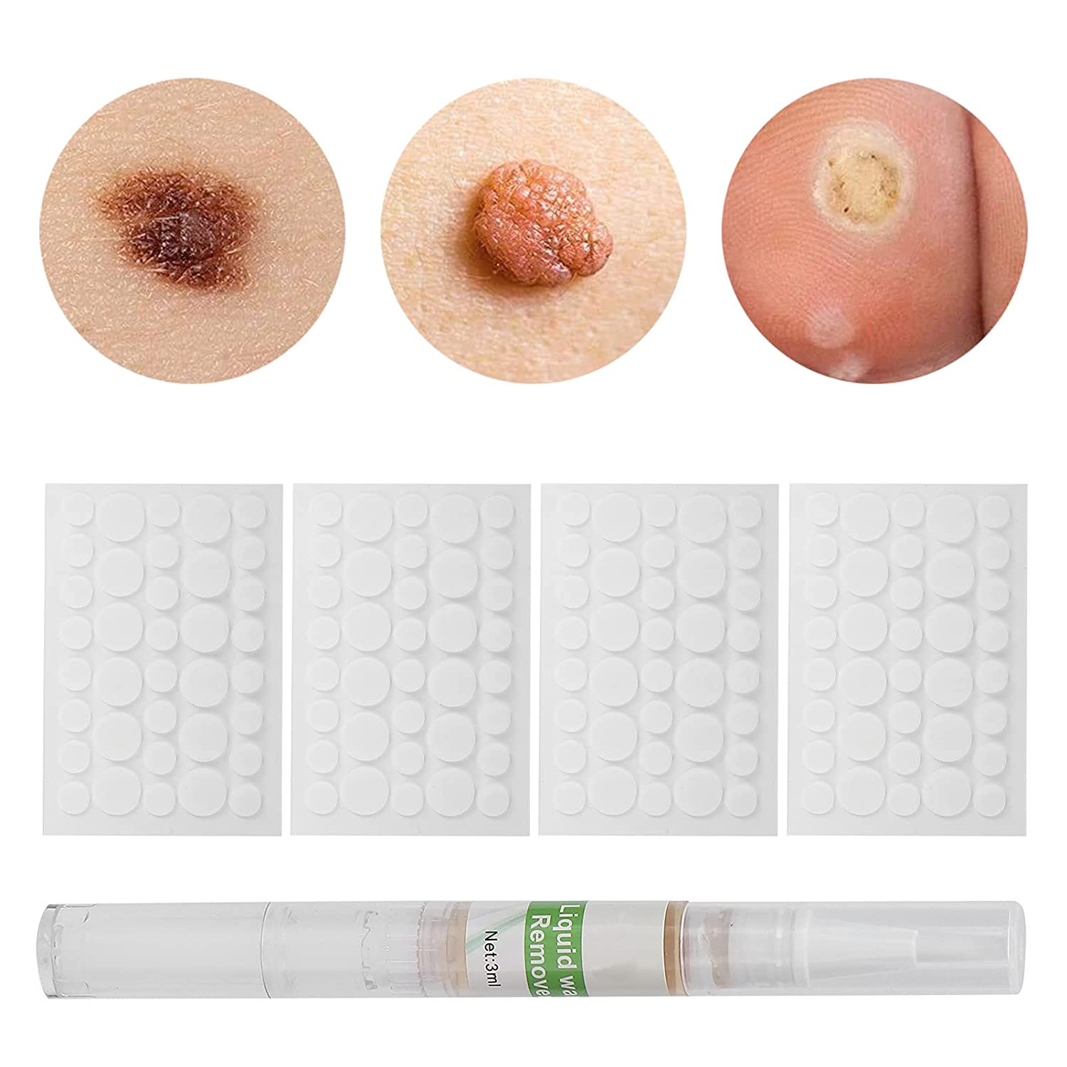 Skin Tag Removal Patches,Skin Tag Remover Patch Pen Wart Removal Stickers Neck Flat Condyloma Easily