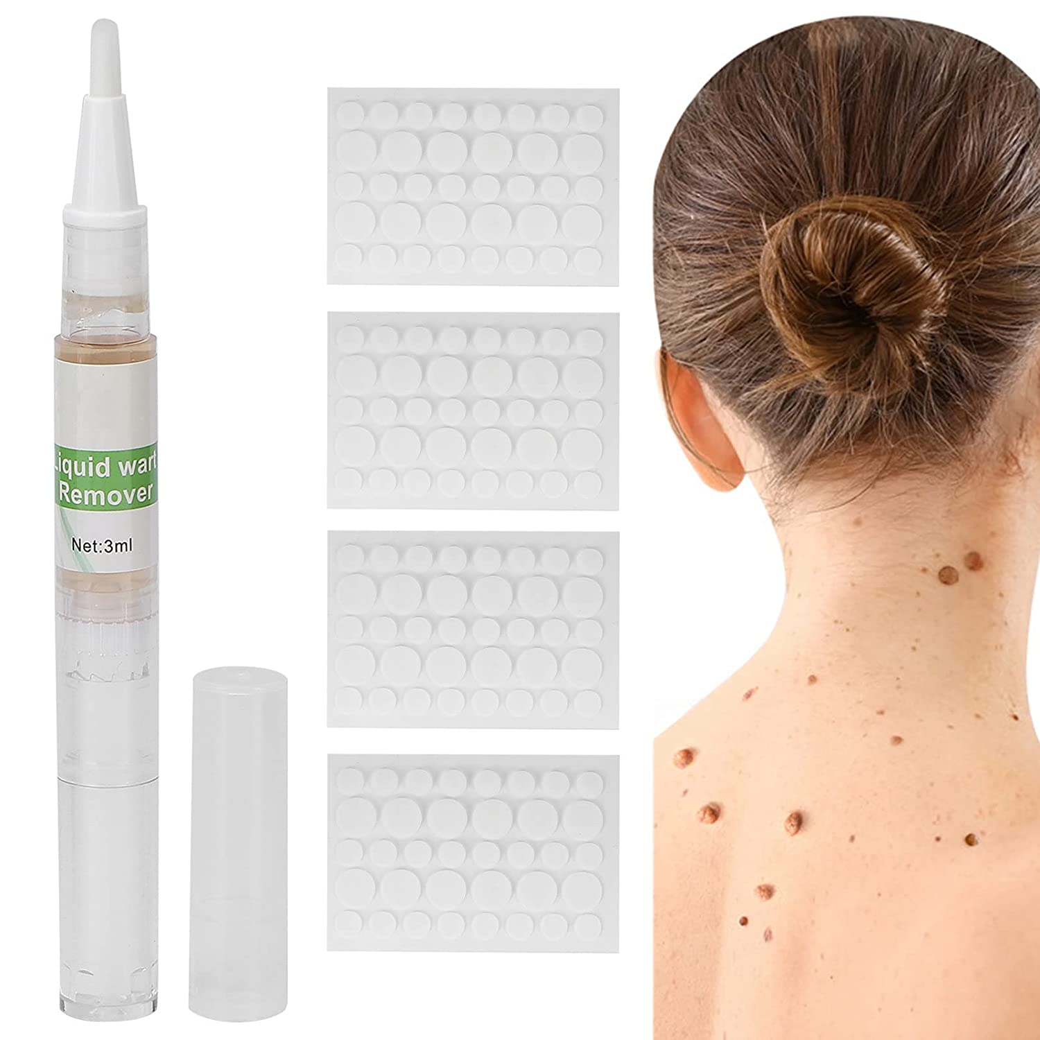 Skin Tag Removal Patches,Skin Tag Remover Patch Pen Wart Removal Stickers Neck Flat Condyloma Easily