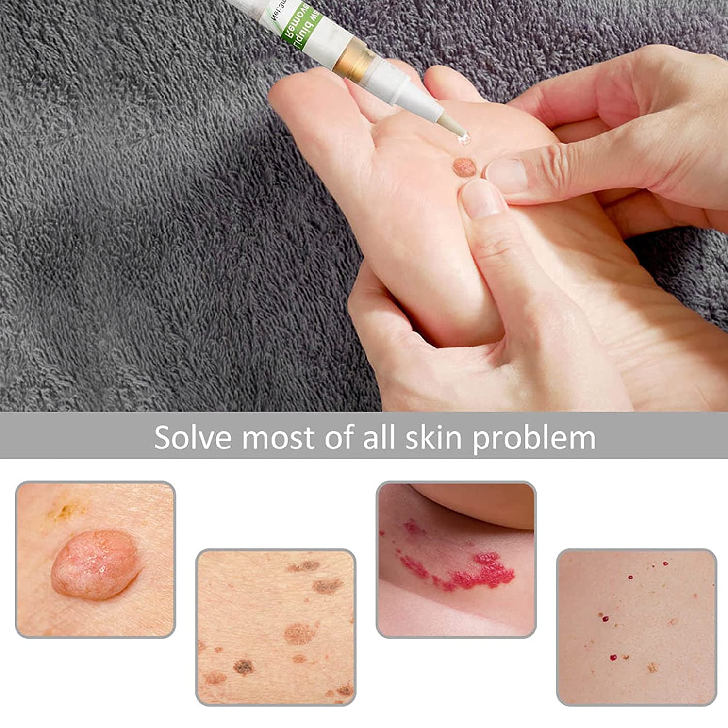 Skin Tag Removal Patches,Skin Tag Remover Patch Pen Wart Removal Stickers Neck Flat Condyloma Easily