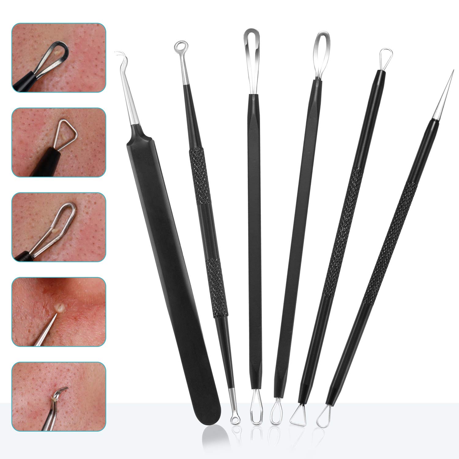 Blackhead Remover Pimple Popper Tool Kit - (6 Piece Kit) - Professional Stainless Pimples Comedone E