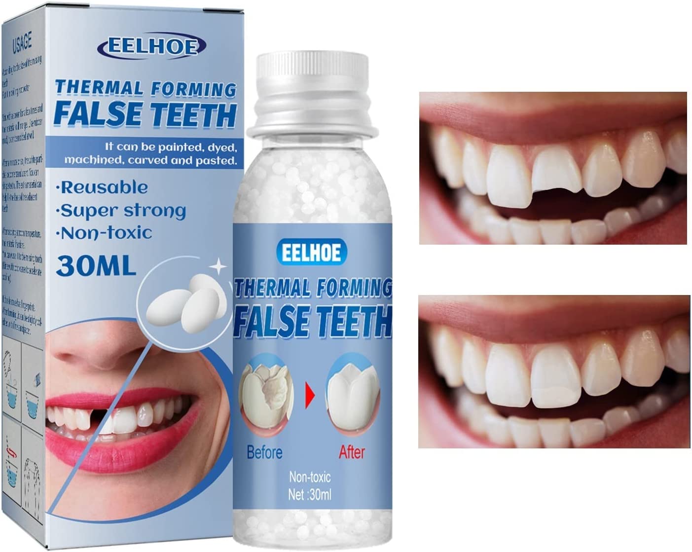 Temporary Tooth Repair Beads - Fake Teeth, Tooth Repair Kit for Temporary Fixing The Missing and Bro