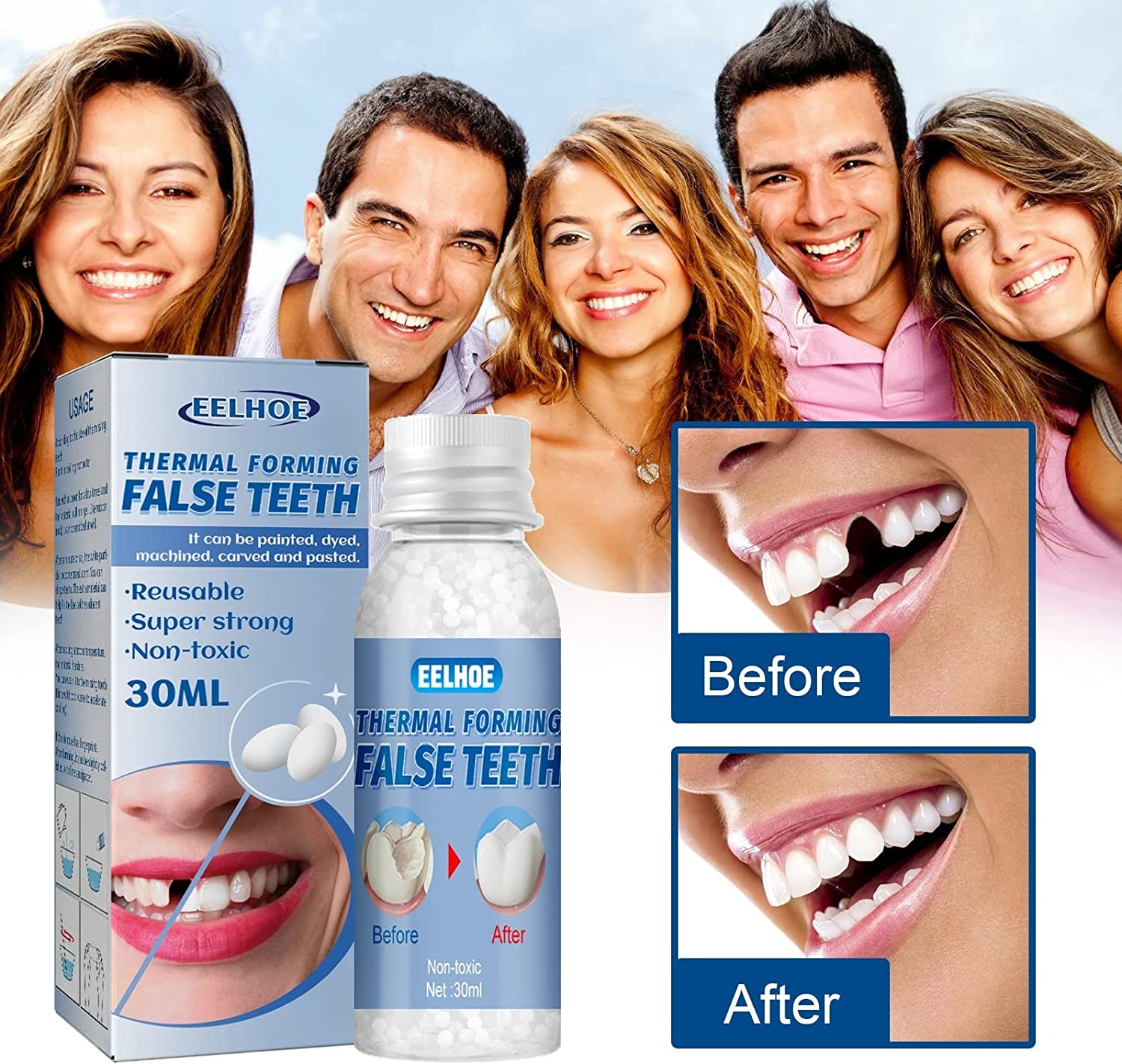 Temporary Tooth Repair Beads - Fake Teeth, Tooth Repair Kit for Temporary Fixing The Missing and Bro