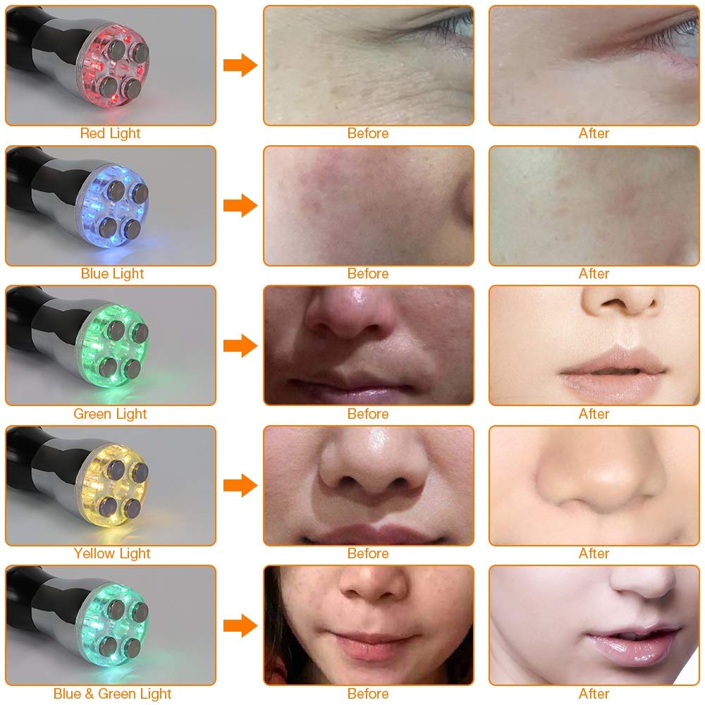 YAVOCOS Facial Frequency Skin Rejuvenation Beauty Care Wrinkle Remove Tighten Skin SPA Care Massager