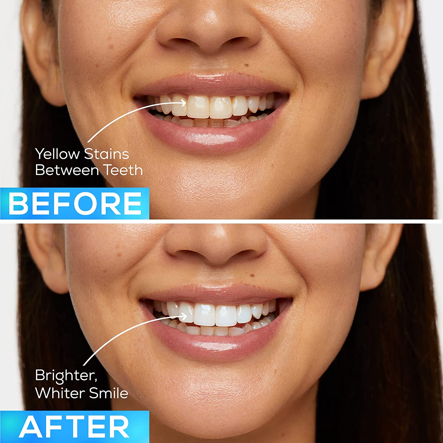 GLO Science GLO Brilliant 3 Pack Teeth Whitening Gel Treatment Kit for Fast, Pain-Free, Long Lasting