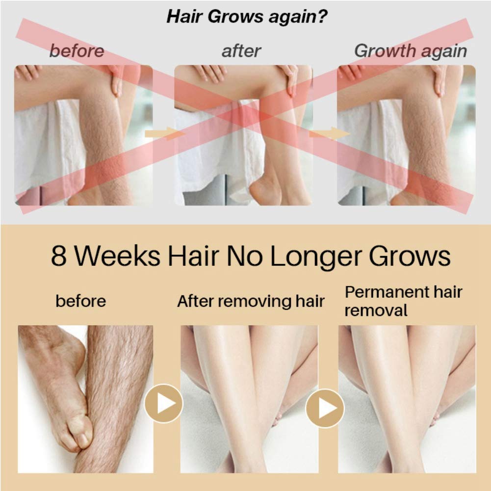 Hair Growth Inhibitor - Hair Removal Spray - Painless and Non-irritating - Hair Stop Growth Spray fo
