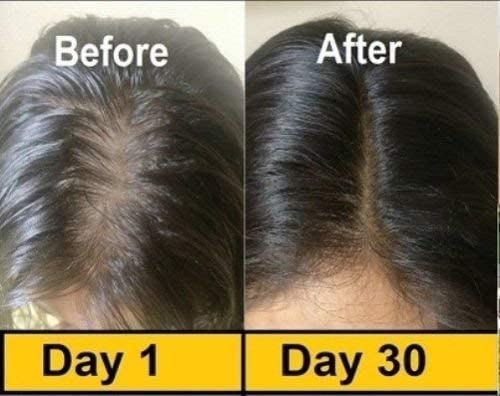 50 Evion Capsules Vitamin E for Glowing Face,Strong Hair,Acne,Nails, Glowing Skin 400mg