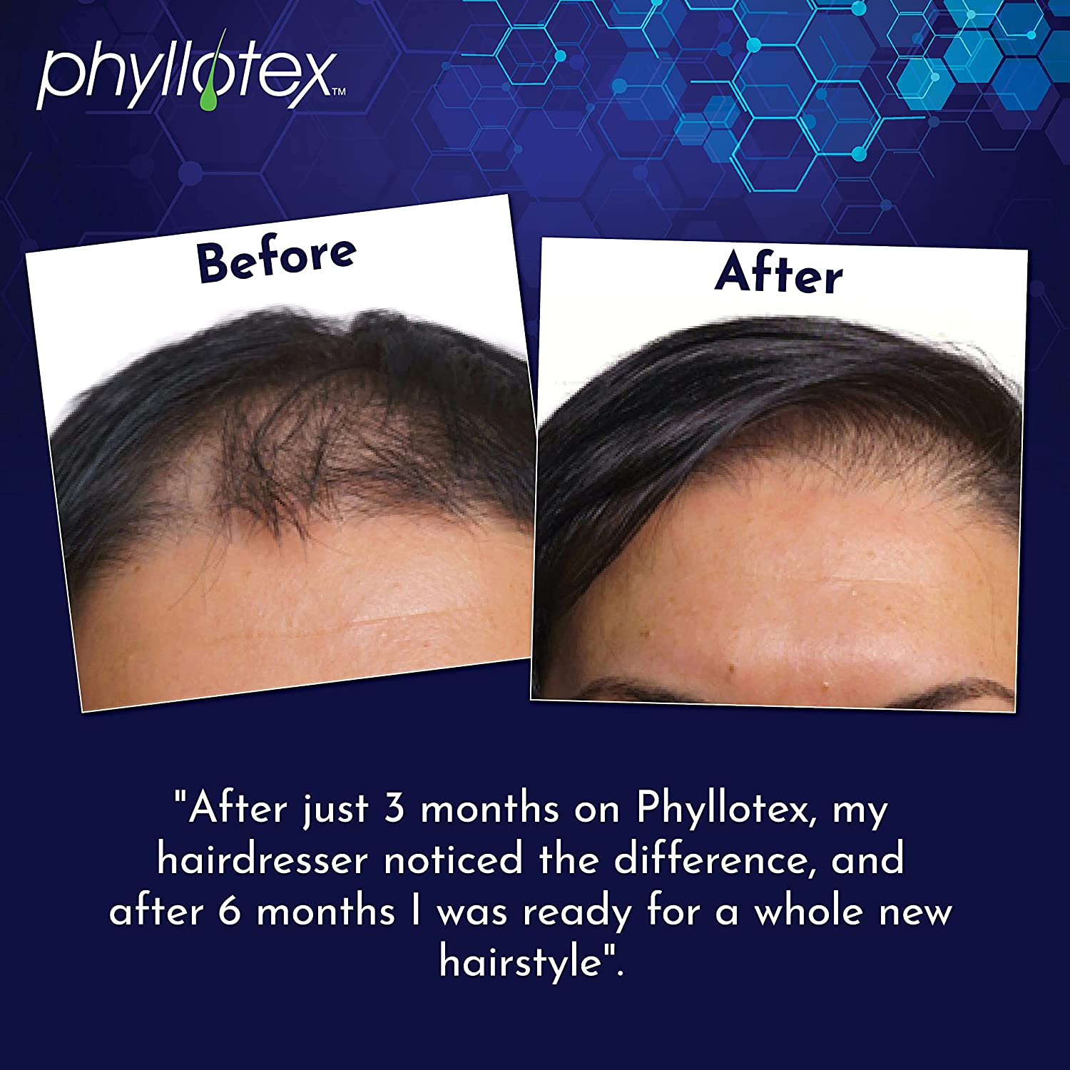 Hair Growth Vitamins for Women and Men by Phyllotex | Scientifically Proven Hair Vitamins for Hair L