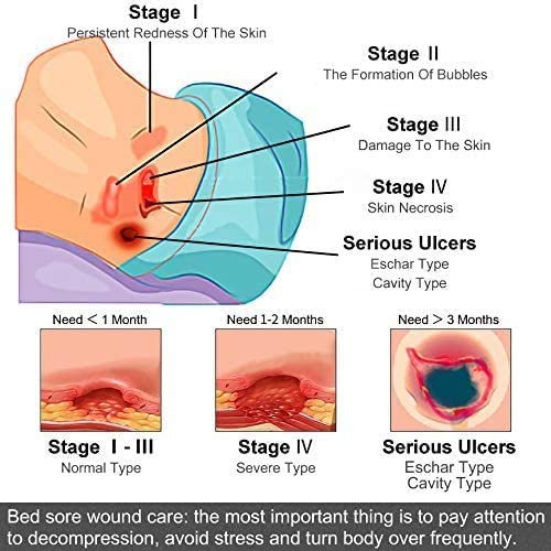 LMNOOP® Bed Sore Cream, Organic Bedsore Ointment, Bed Sores Treatment, Intense Fast Wound Healing O