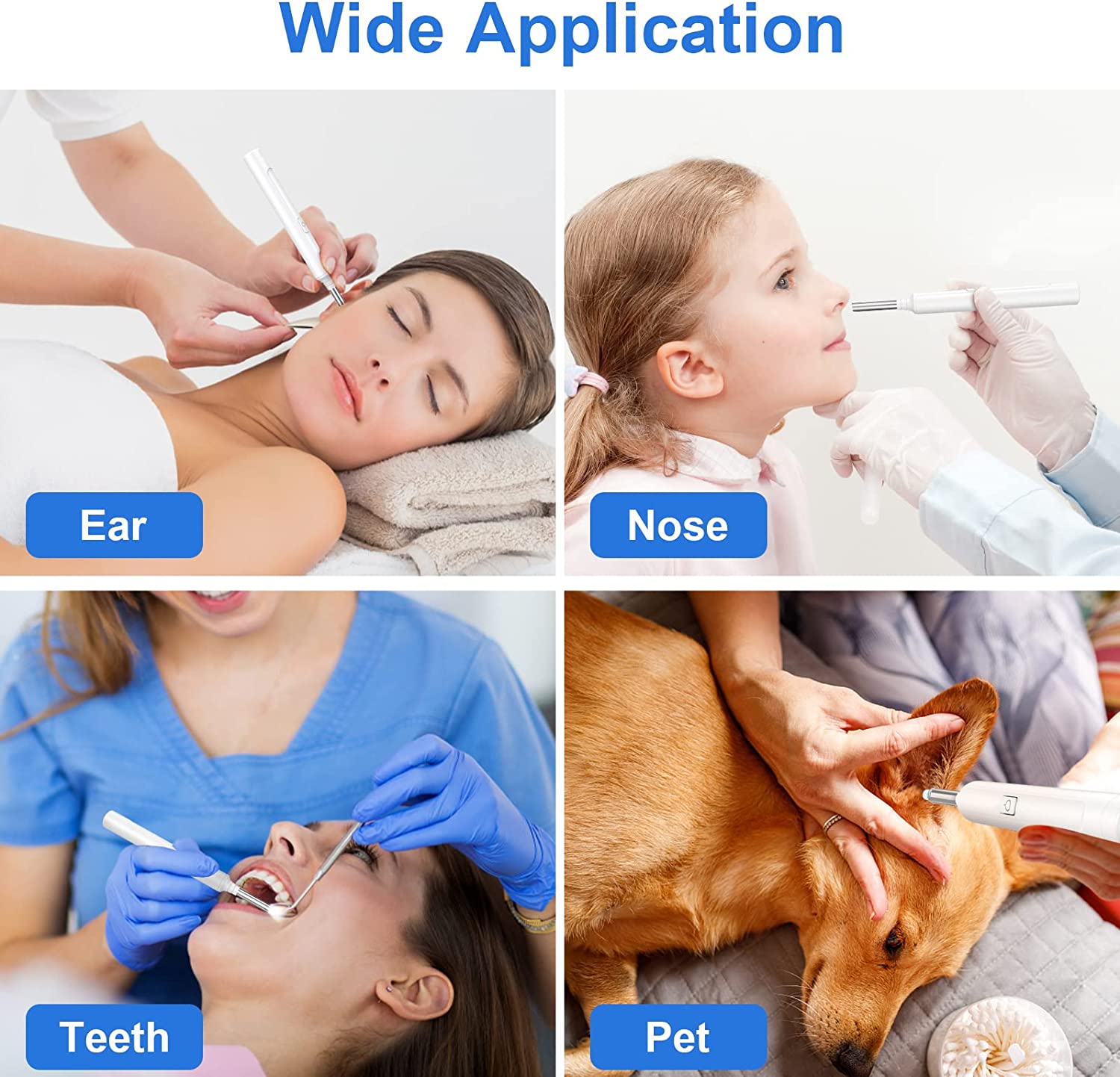 Ear Wax Removal, Earwax Remover Tool with 1296P FHD Ear Camera, 6 Low-Temp LED Lights, Ear Cleaner C