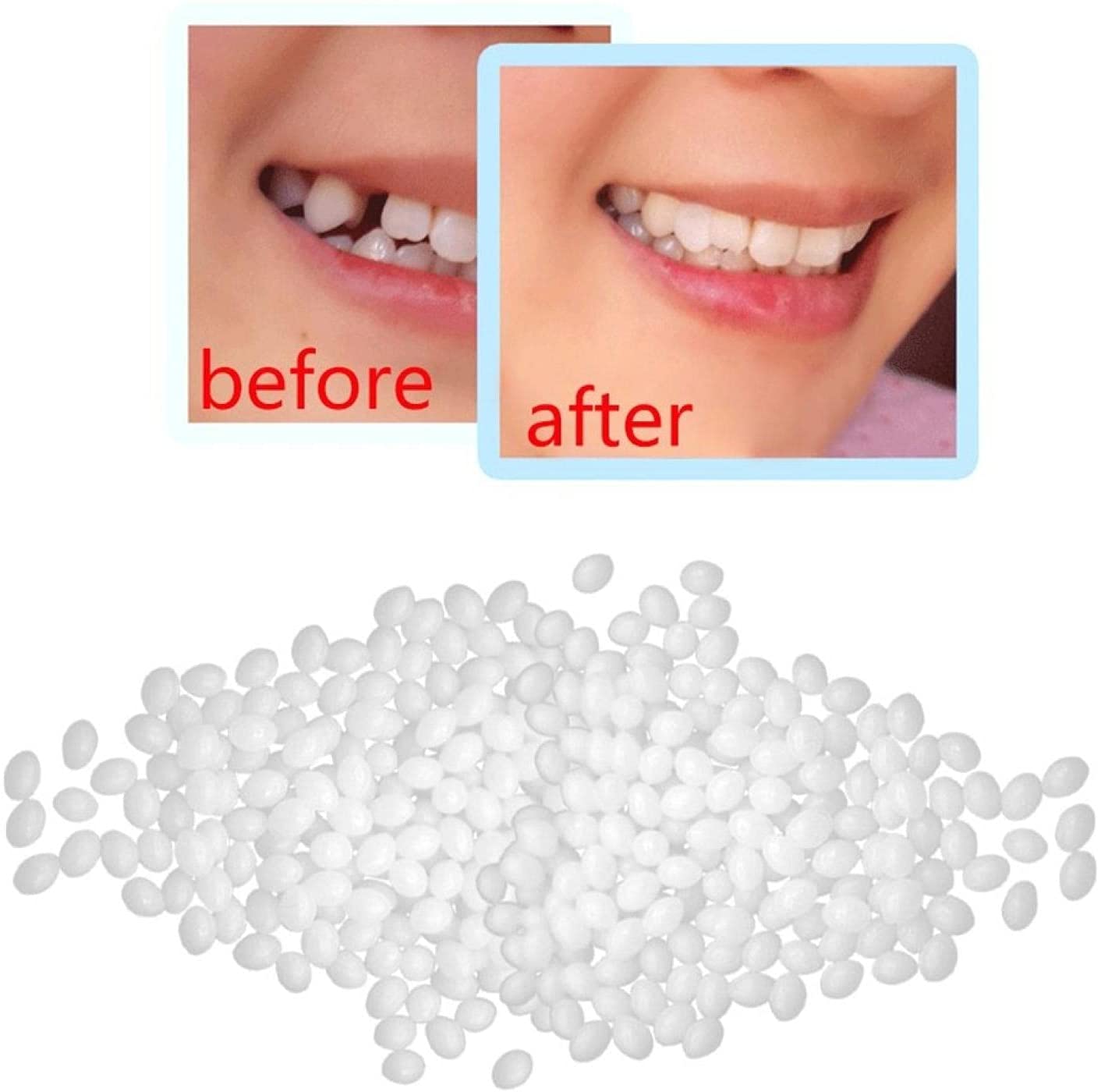 Temporary Tooth Repair Kit Dental Restoration Kit Dental Repair Solid Gel Teeth and Interstitial
