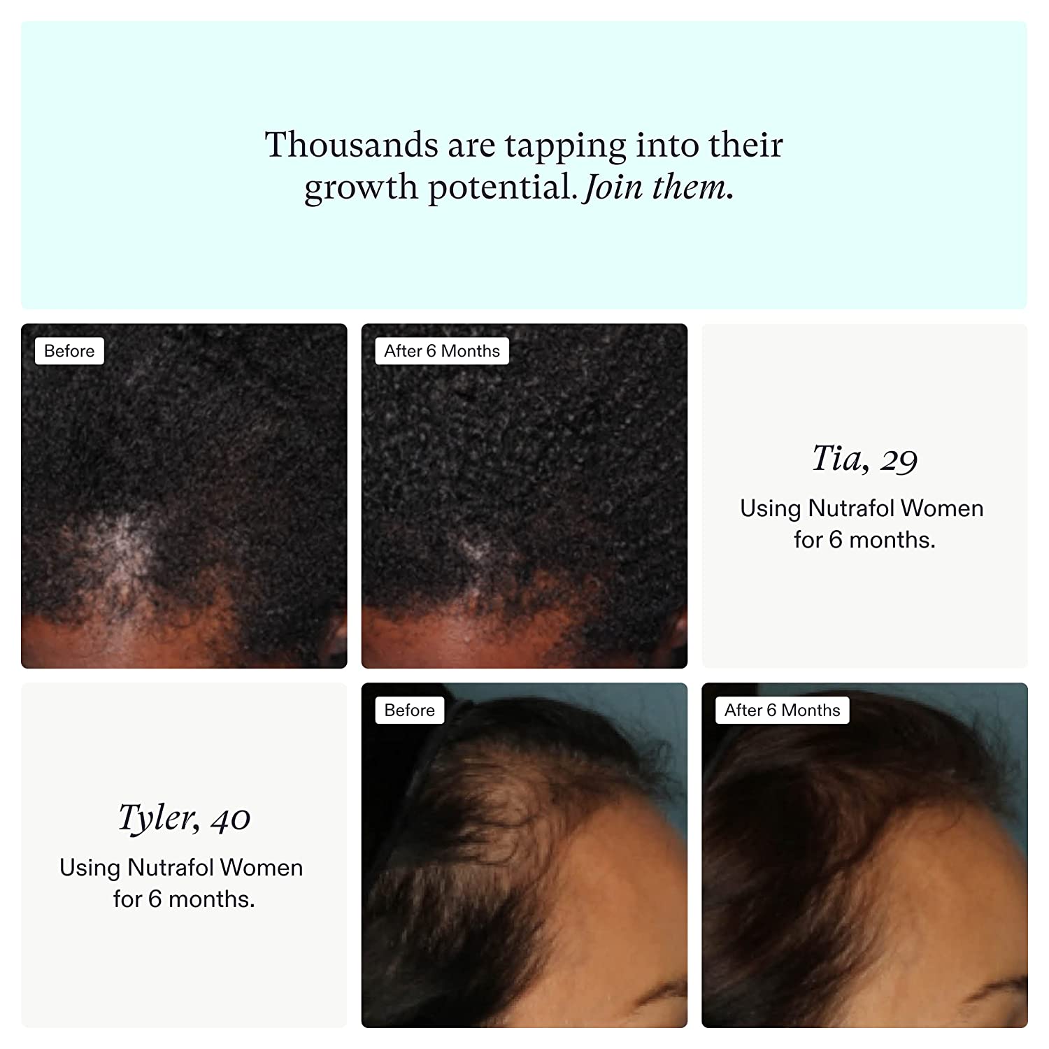 Nutrafol Women Hair Growth For Thicker, Stronger Hair (4 Capsules Per Day) (1 Month Supply)