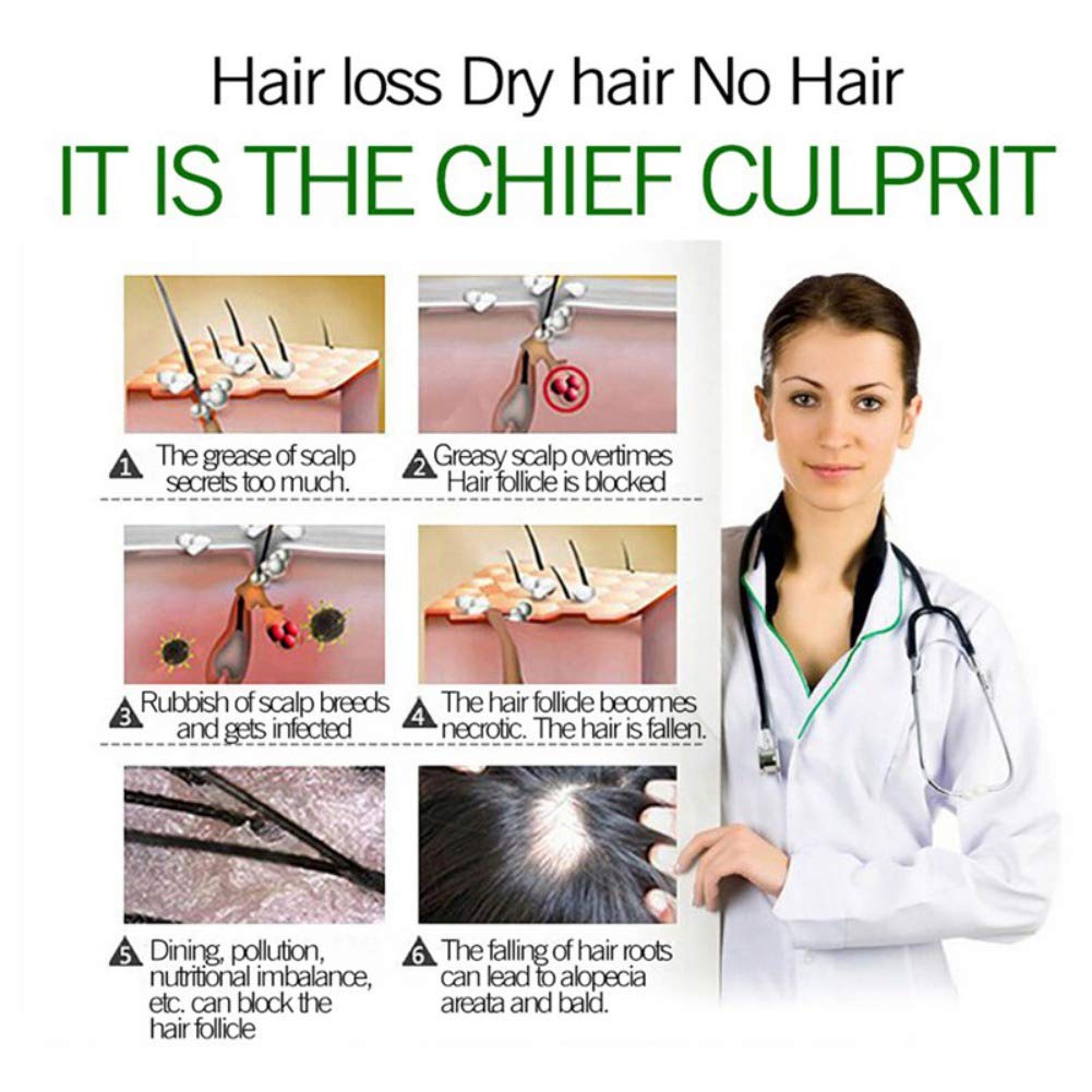 30ml Natural Ginger Hair Growth Essence, Fast Regenerative Anti-Hair Loss Treatment Care, Hair Thinn