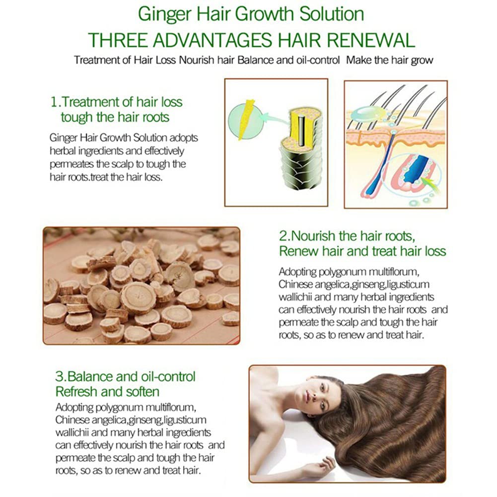 30ml Natural Ginger Hair Growth Essence, Fast Regenerative Anti-Hair Loss Treatment Care, Hair Thinn