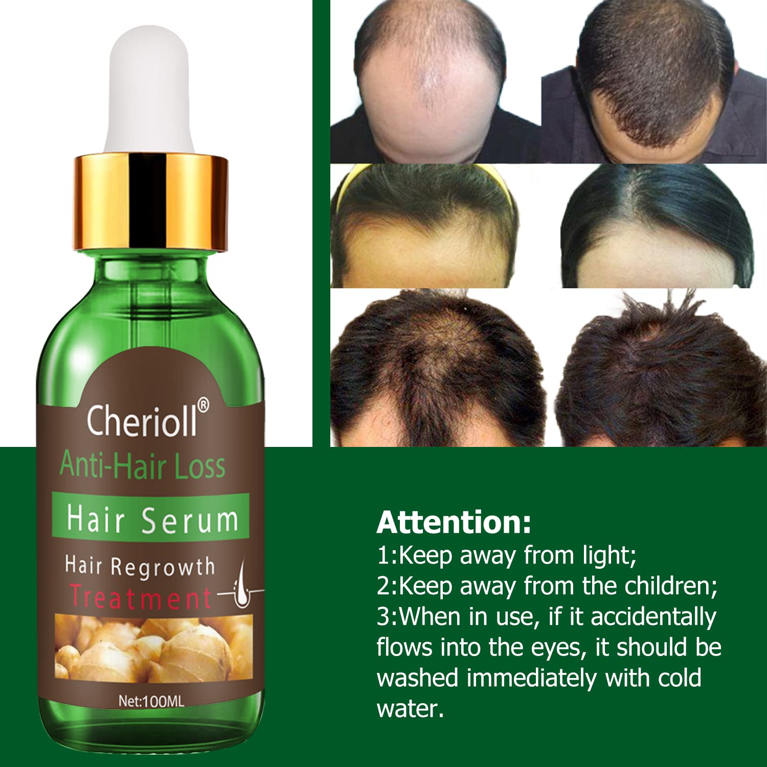Hair Growth Serum 80ML