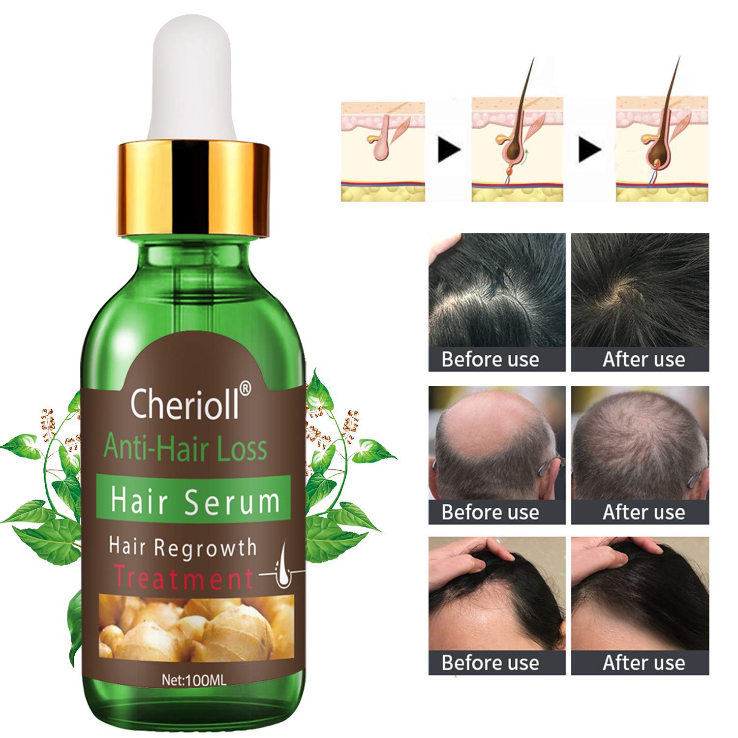 Hair Growth Serum 80ML