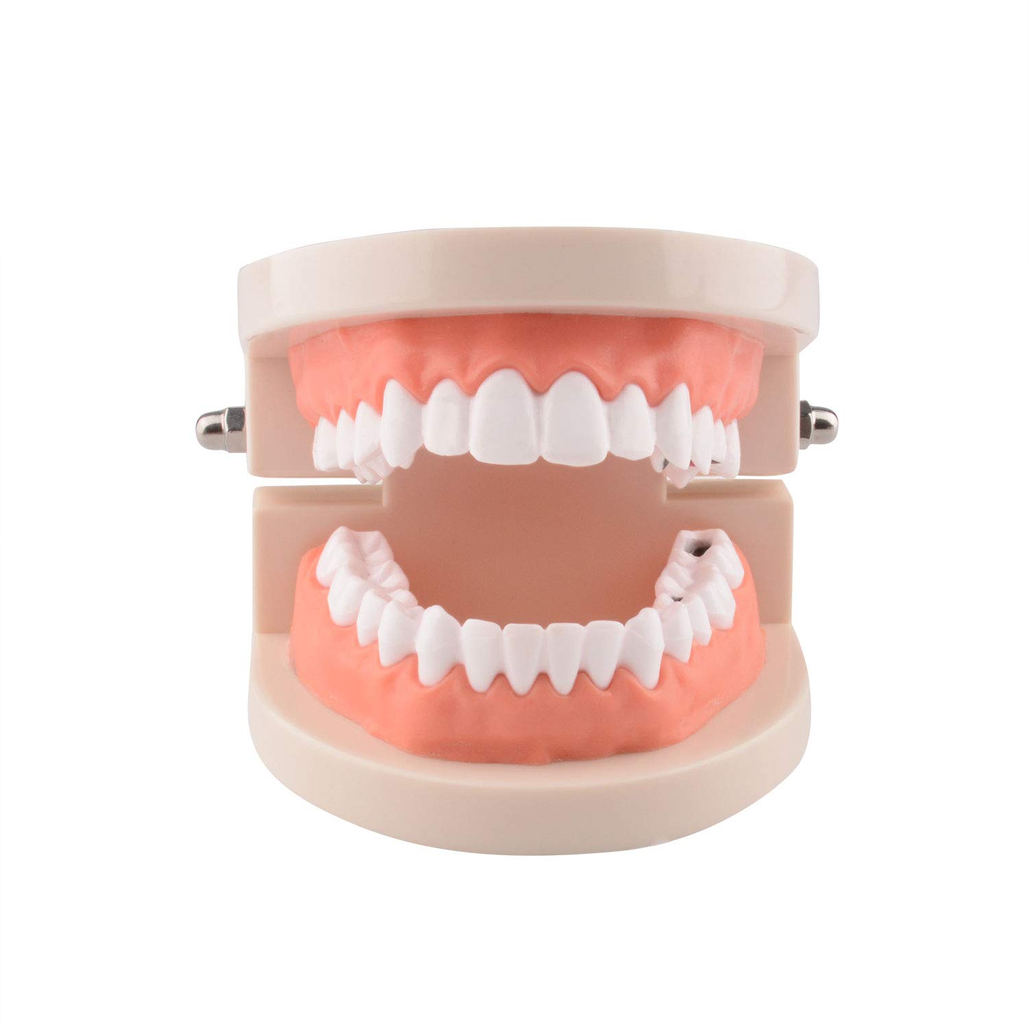 Ultrassist Dental Caries Study Model, 1:1 Life Size Fake Adult Dental Tooth Decay Model, Dental Hygi