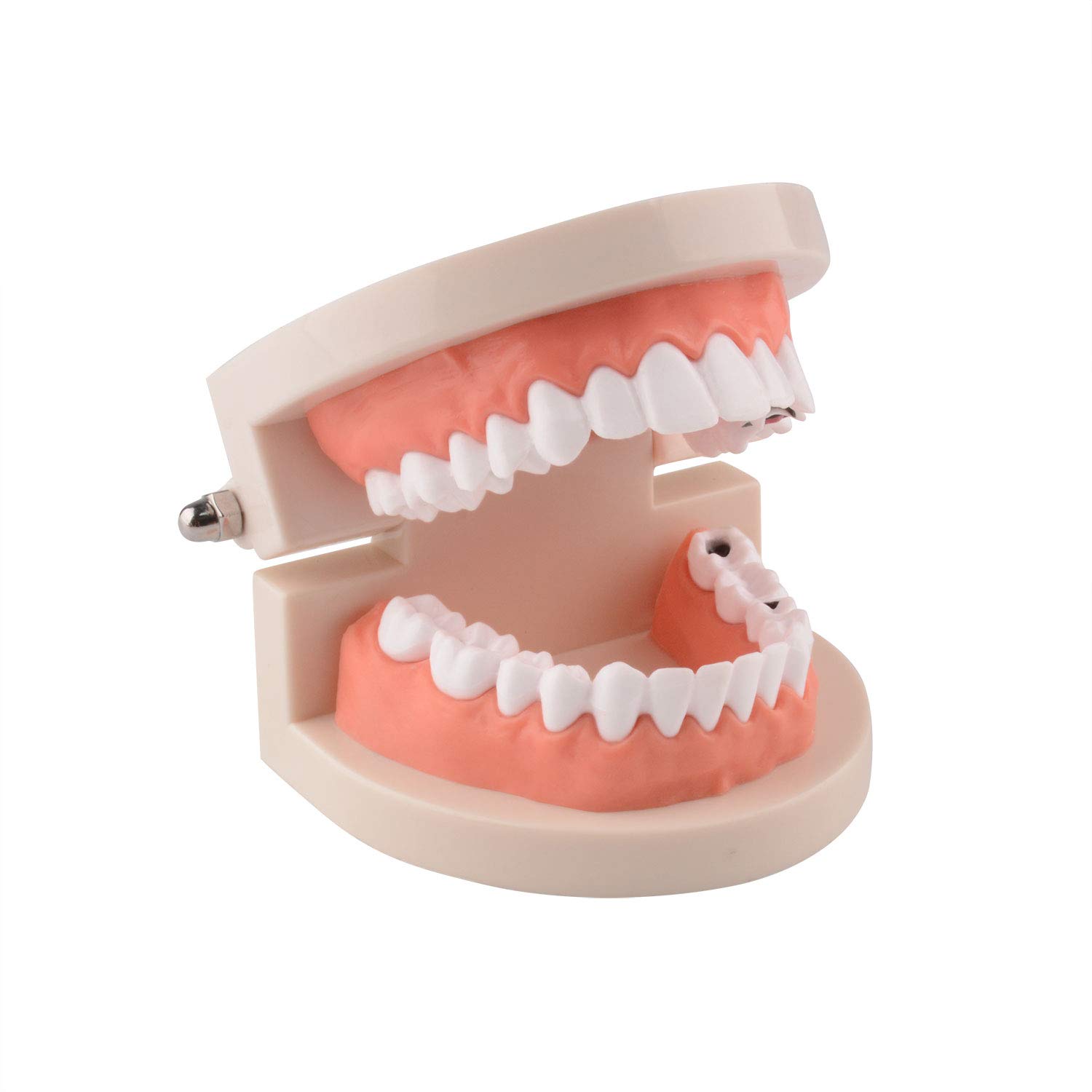 Ultrassist Dental Caries Study Model, 1:1 Life Size Fake Adult Dental Tooth Decay Model, Dental Hygi