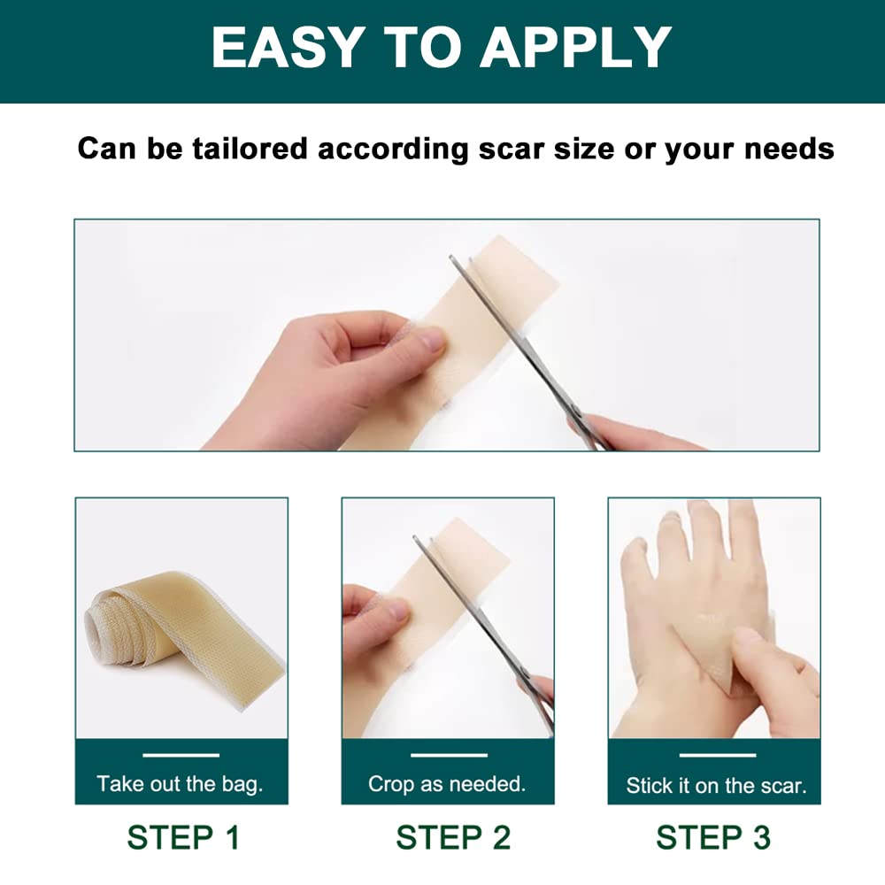 Silicone Scar Sheets, 1.6”x 120” Long Tape Roll, Reusable, Medical Grade Silicone Scar Removal S