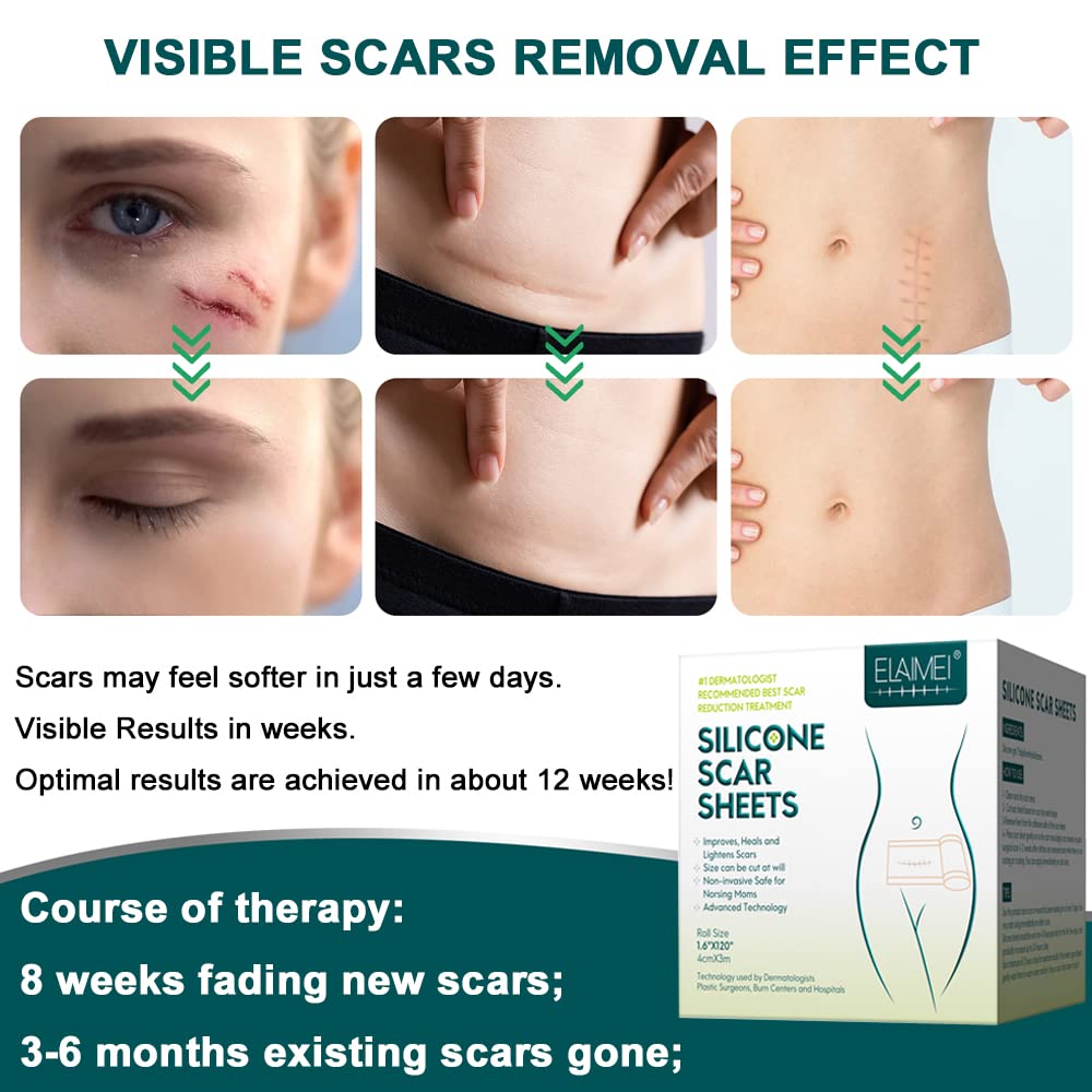 Silicone Scar Sheets, 1.6”x 120” Long Tape Roll, Reusable, Medical Grade Silicone Scar Removal S