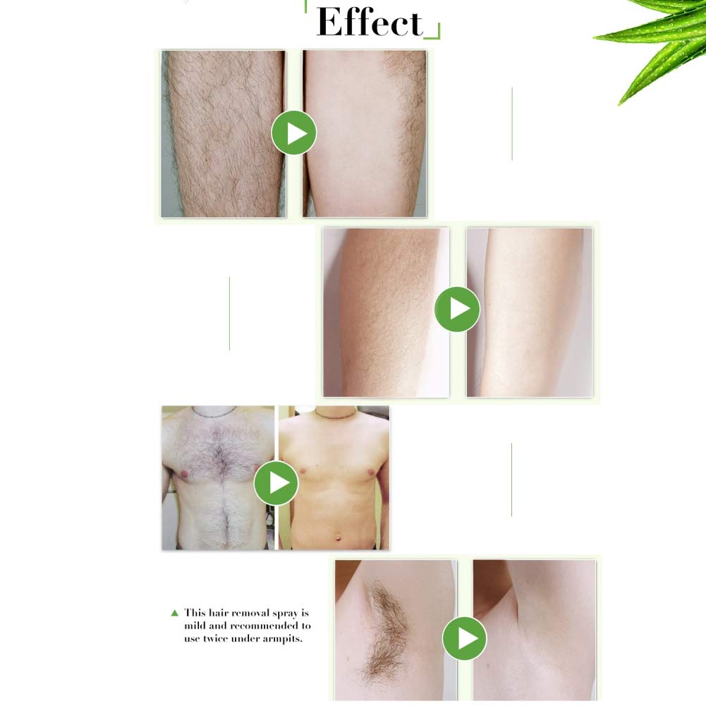 Novobey Hair Removal Spray, Hair Growth Inhibitor, Reducing to Stop Hair Growth Gentle Smooth Painle