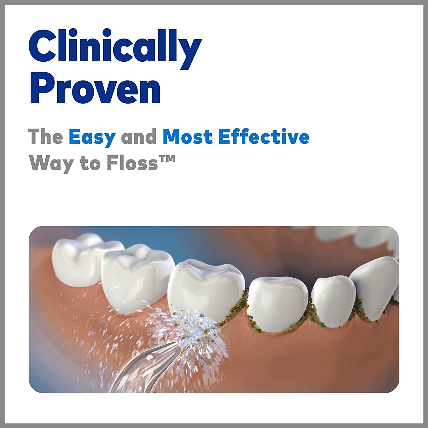 Waterpik Wp-861 Blue/White Complete Care 5.0