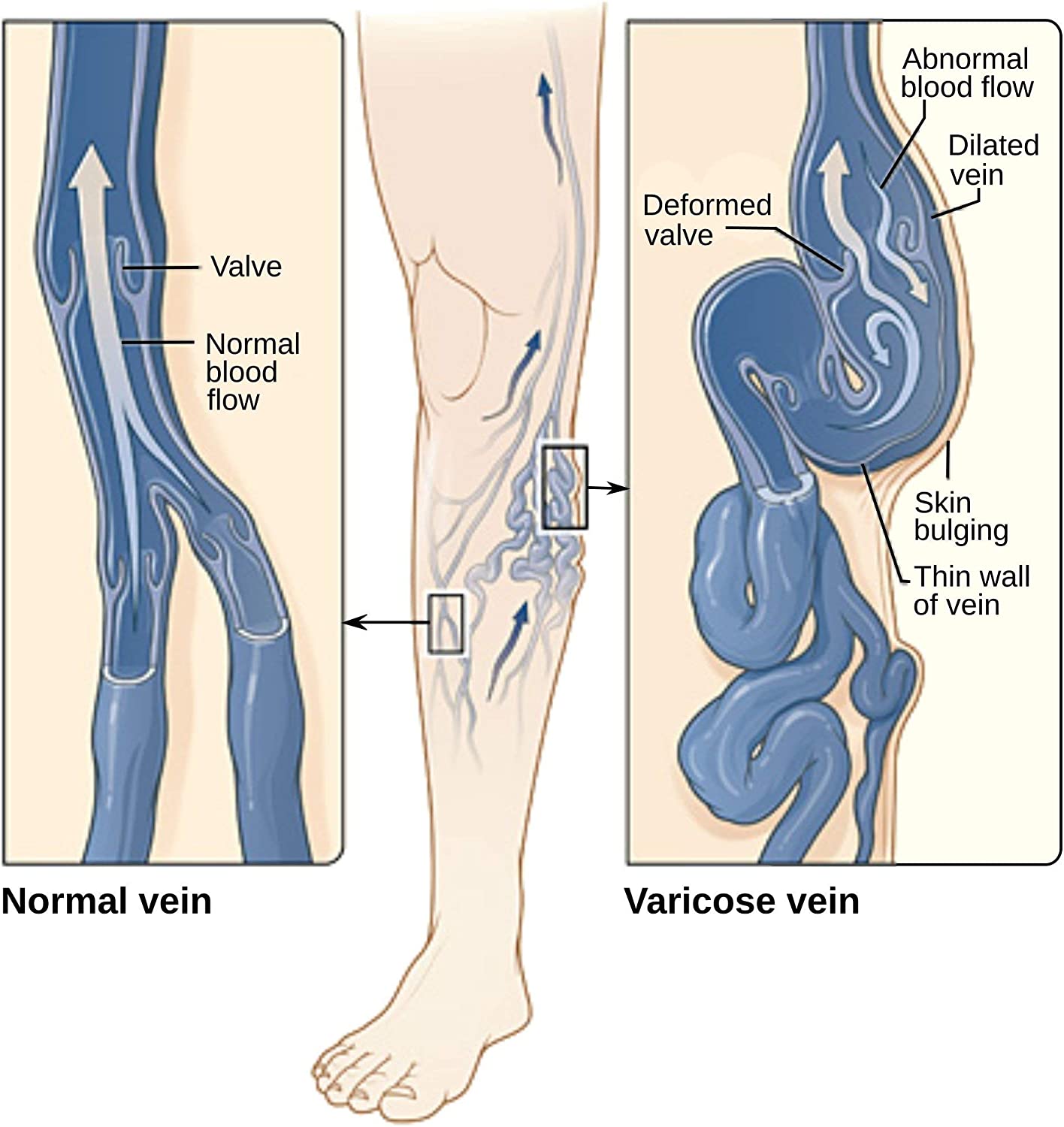 Varicose Vein Treatment - Leg Circulation Supplement - Diosmin Leg Vein Support - Circulation Vein S