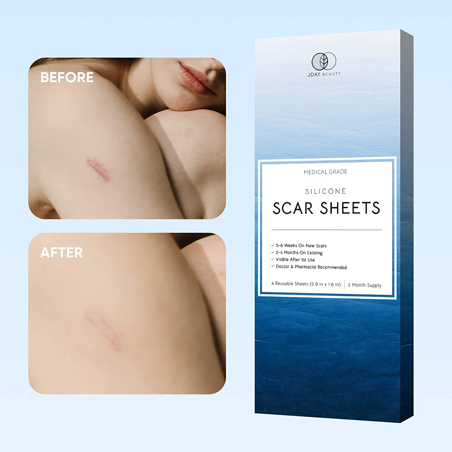 Silicone Scar Removal Sheets - Breathable Reusable & Waterproof Keloid Scar Removal Patches Caused b