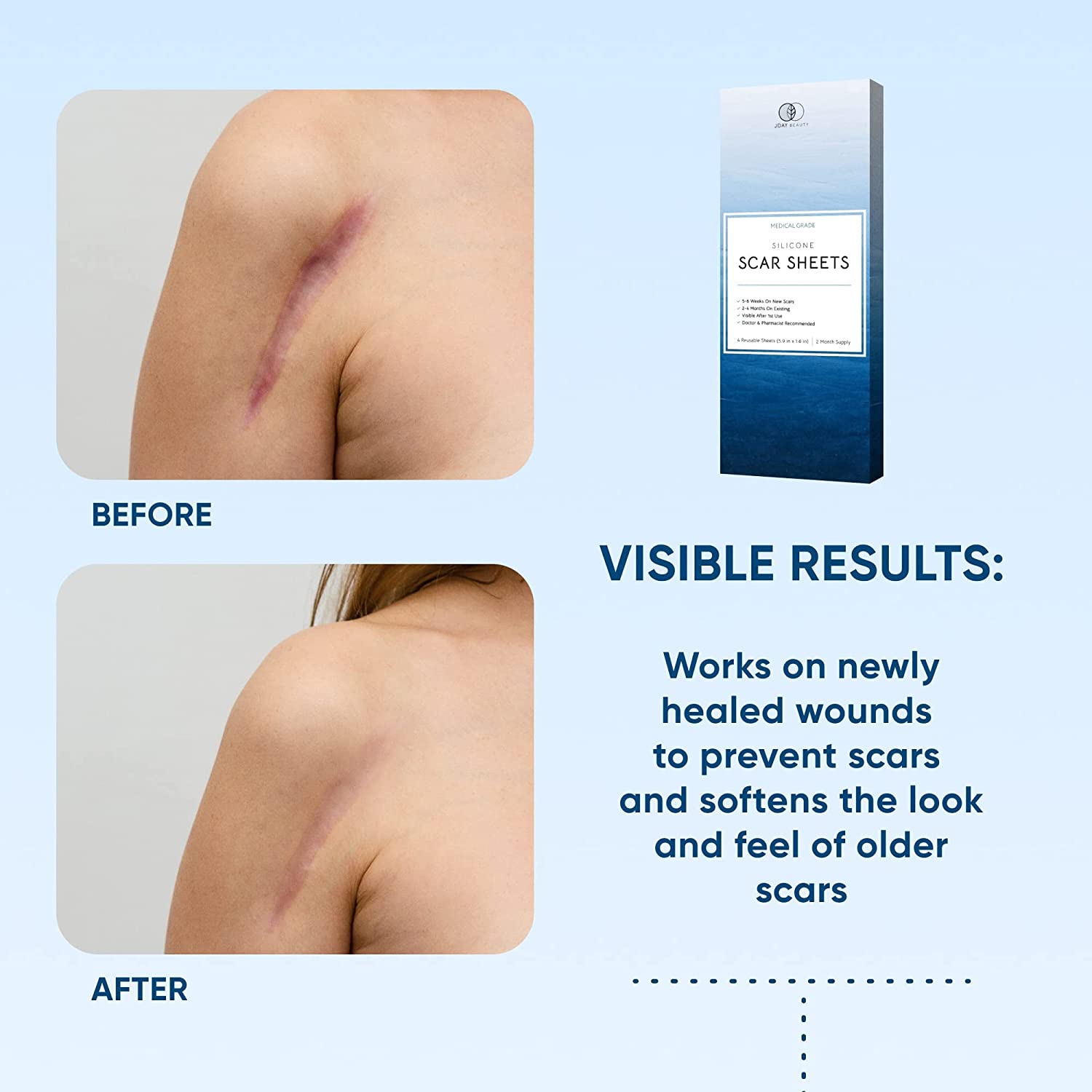 Silicone Scar Removal Sheets - Breathable Reusable & Waterproof Keloid Scar Removal Patches Caused b