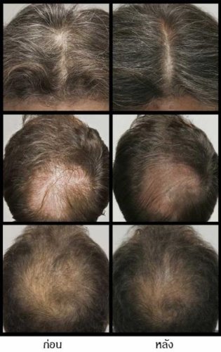 BIO WOMAN Re Hair Tonic Extra For Chronic Hair Loss Size 100ml by