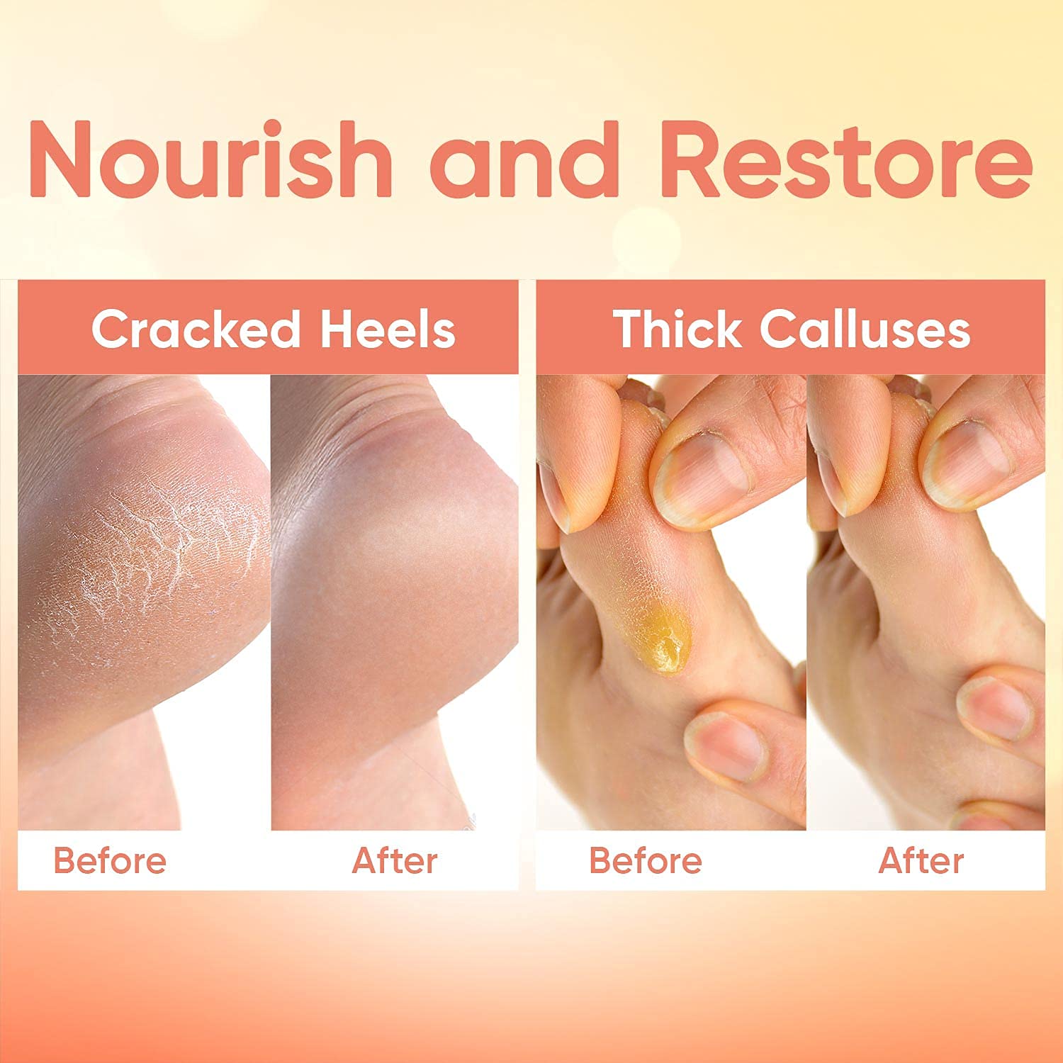 Foot Peel Mask Peach (2 Pairs) - Foot Mask for Dry Cracked Feet and Remove Dead Skin - Foot Exfoliat