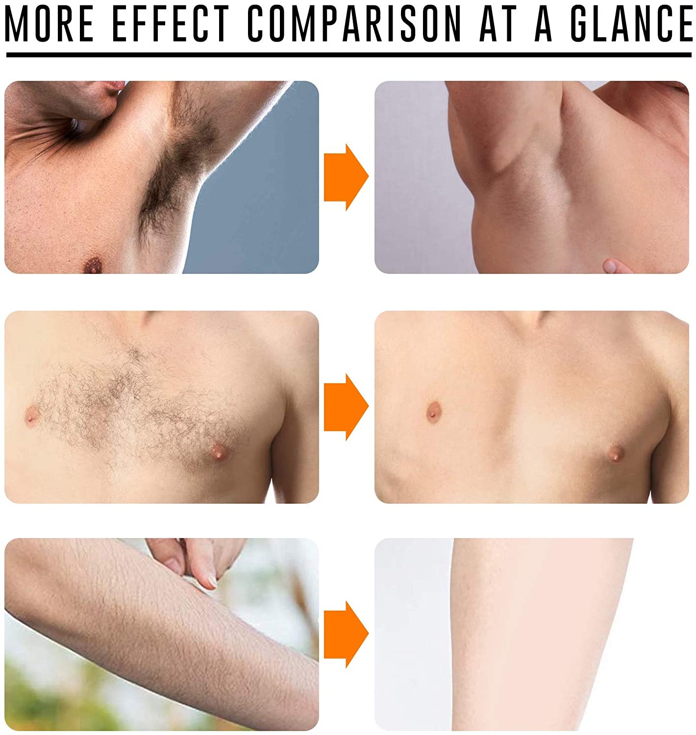 Simayixxch Natural Permanent Hair Removal Spray Inhibitor Stops Growth 50ml Smooth Warm Solidificati