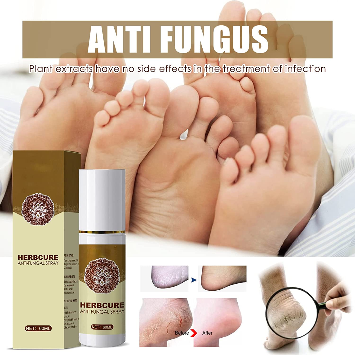 60ml Fungal Combat Feet Spray , Anti Fungal Infections Athlete