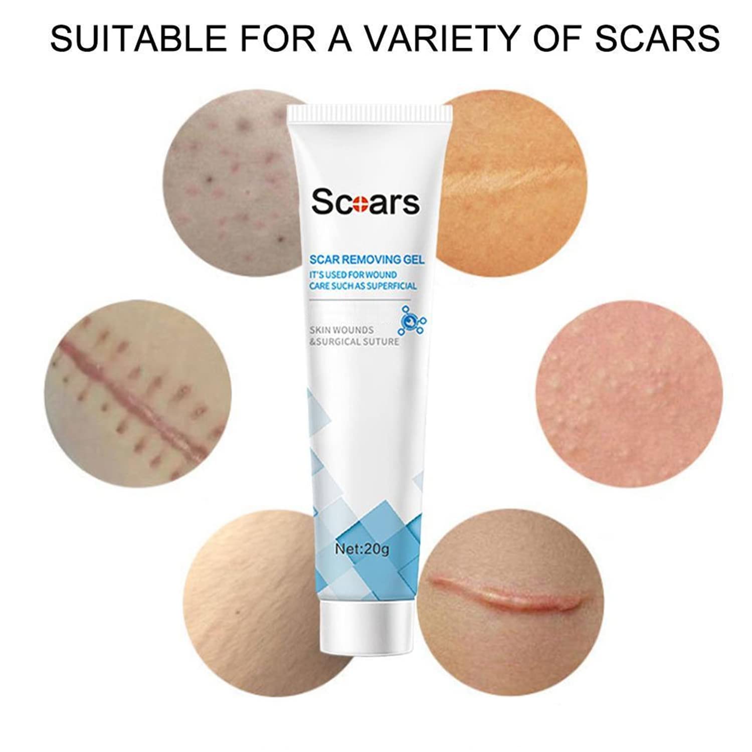 Organic Scar Removing Gel, Scar Removal Cream for Old Scars, Scar Repair Gel Cream for Man and Women
