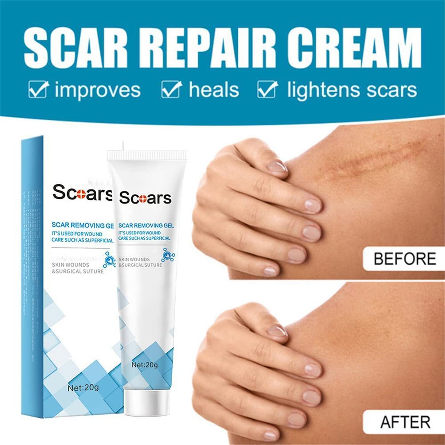 Organic Scar Removing Gel, Scar Removal Cream for Old Scars, Scar Repair Gel Cream for Man and Women