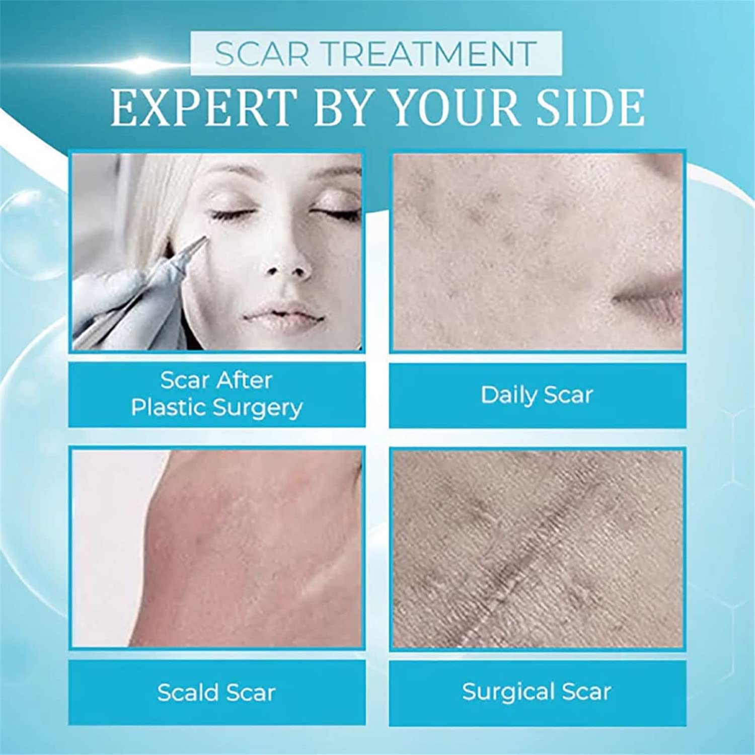 Organic Scar Removing Gel, Scar Removal Cream for Old Scars, Scar Repair Gel Cream for Man and Women