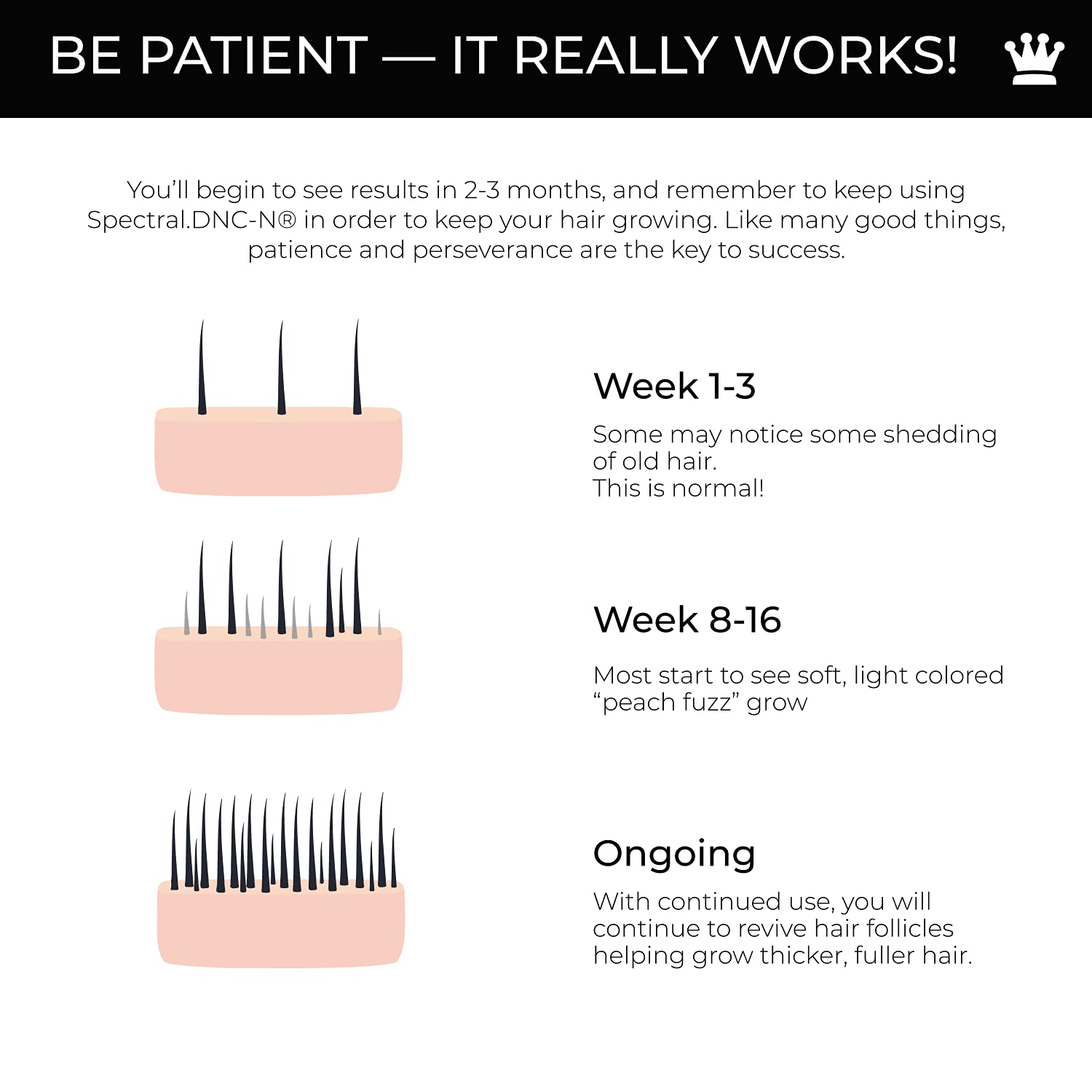 Spectral.UHP | Extra Strength Hair Regrowth Treatment with Minoxidil 5%