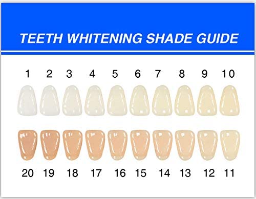Dream White at Home Teeth Whitening Kit