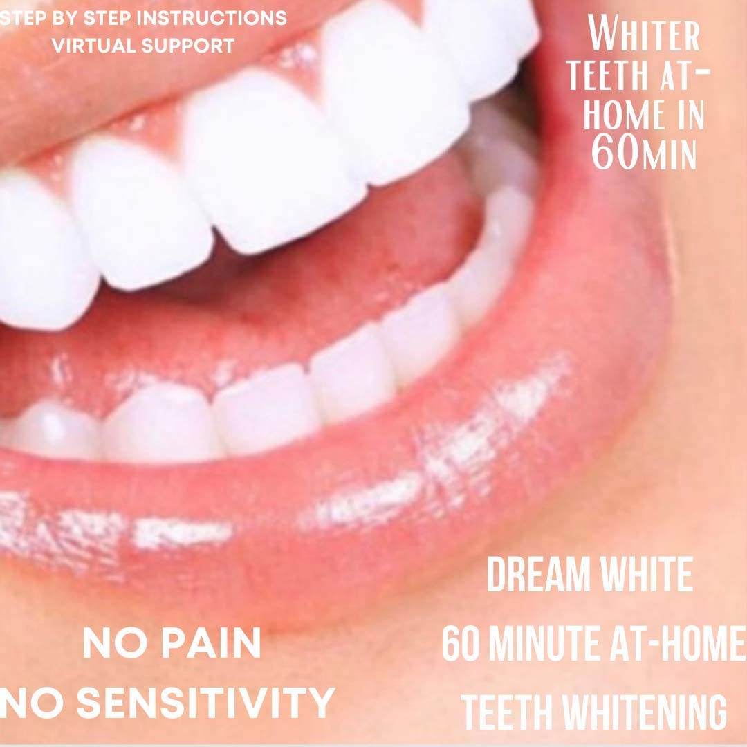 Dream White at Home Teeth Whitening Kit