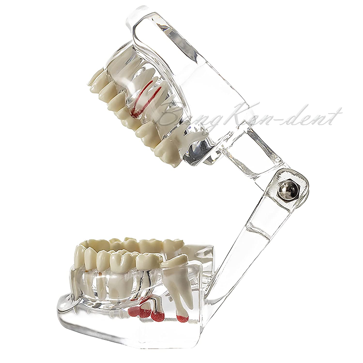 Dental Teeth Model Implant Model Teach Study Demo Tooth Analysis Demonstration Teeth Restoration 200