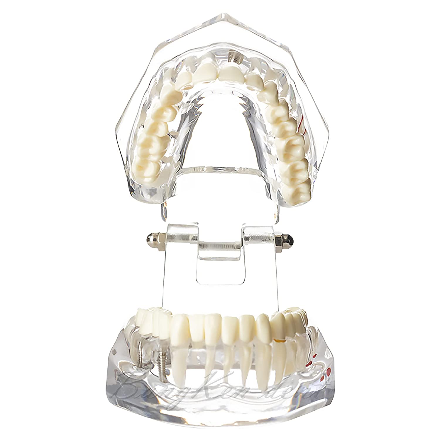 Dental Teeth Model Implant Model Teach Study Demo Tooth Analysis Demonstration Teeth Restoration 200